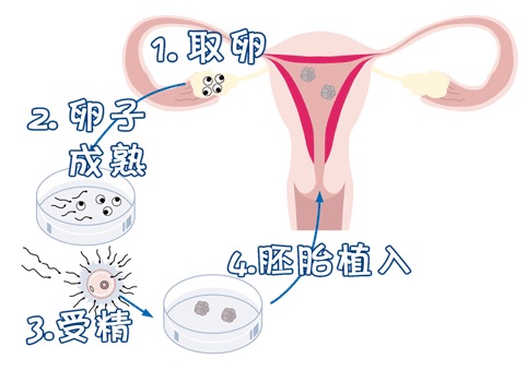 供卵孕妈带怀服务机构
